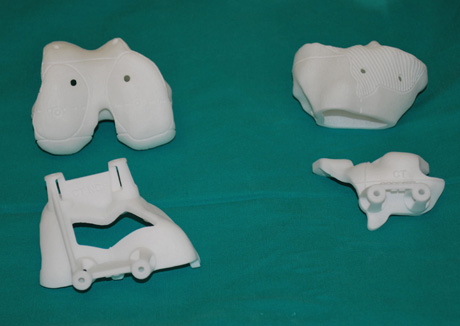 Ειδικοί εξατομικευμένοι οδηγοί πάνω στα 3D printing προπλάσματα του γόνατος του ασθενούς (μηριαίο και κνήμη)